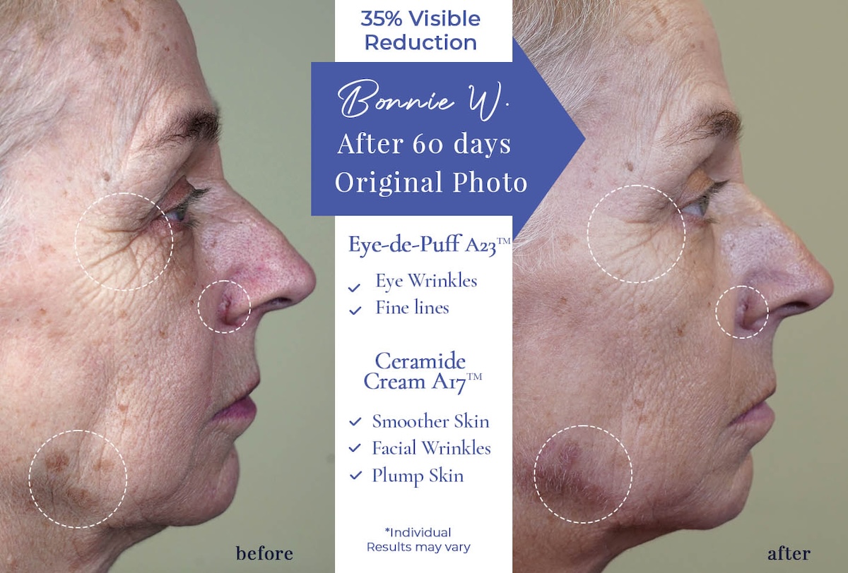 Bonnie Before-After Ceramide Cream 4
